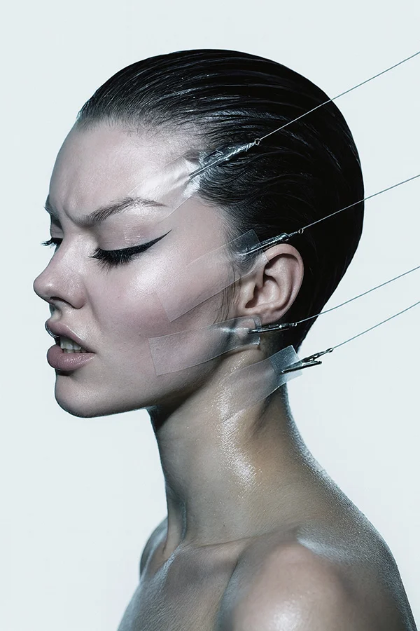 Side profile of a white woman deplicting endoscopic Facelift