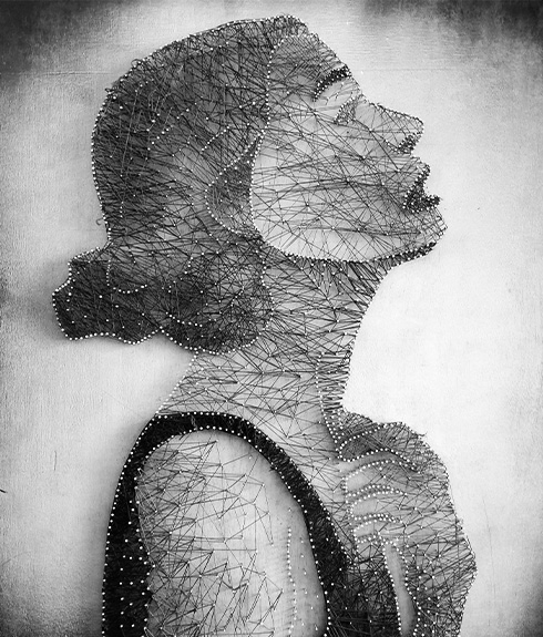 Strings artwork deplicting chin surgery